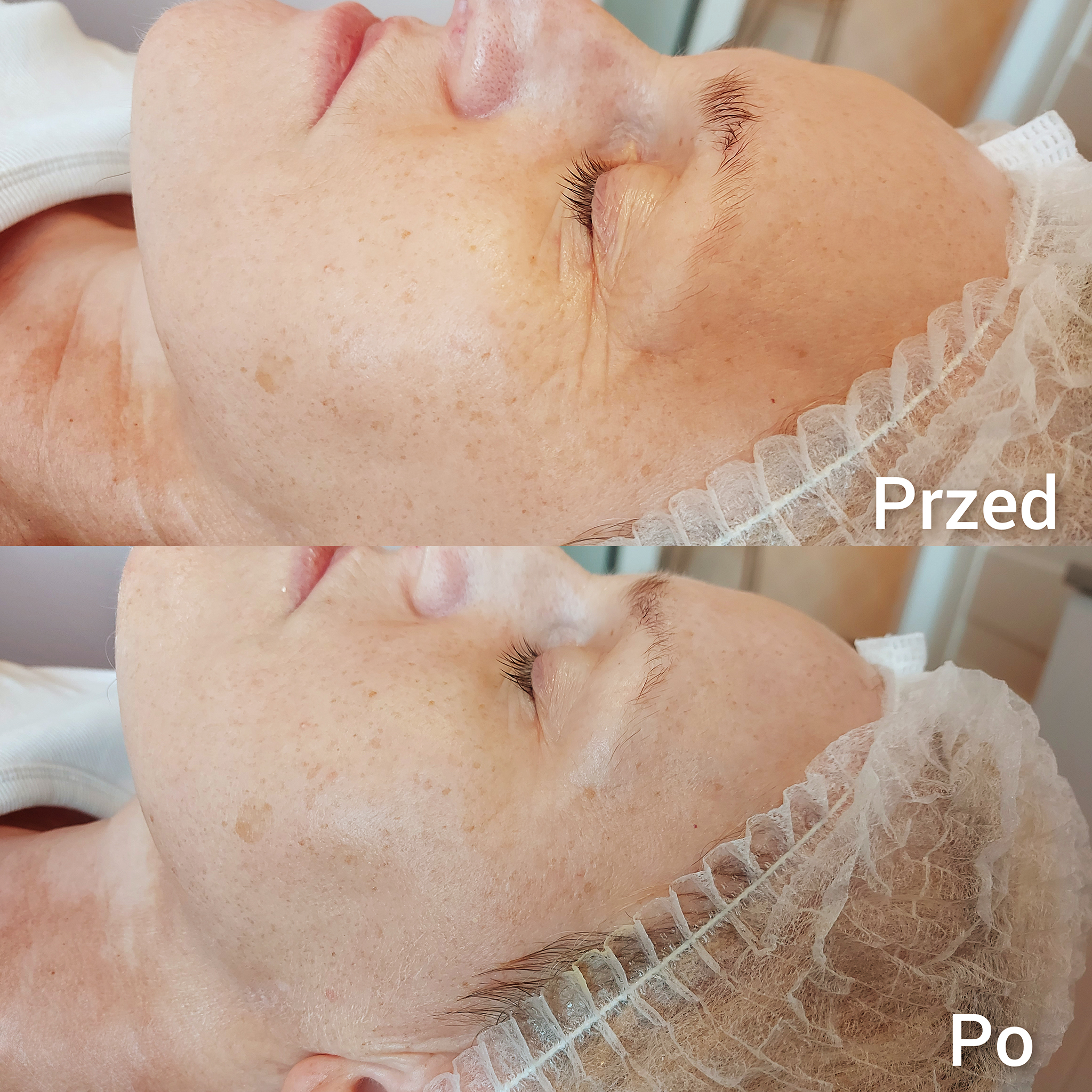 Fale Radiowe Opinie 1