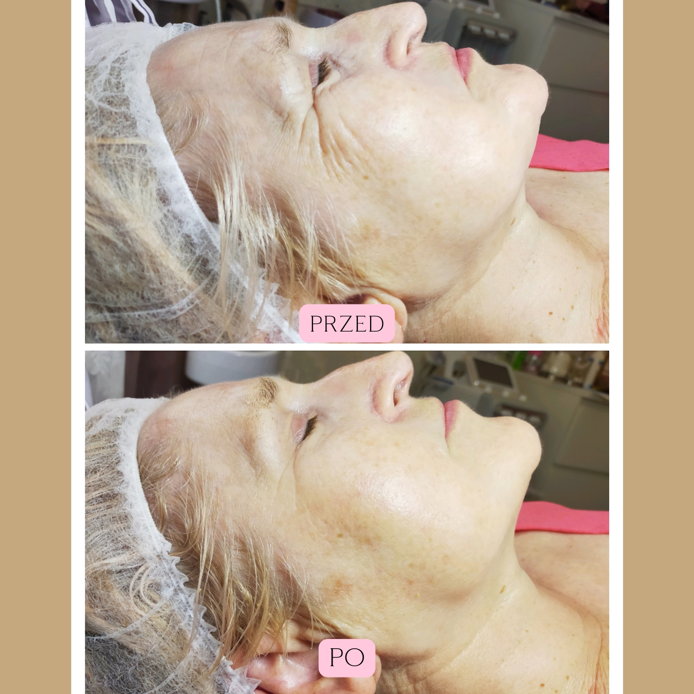 Fale Radiowe Opinie 2