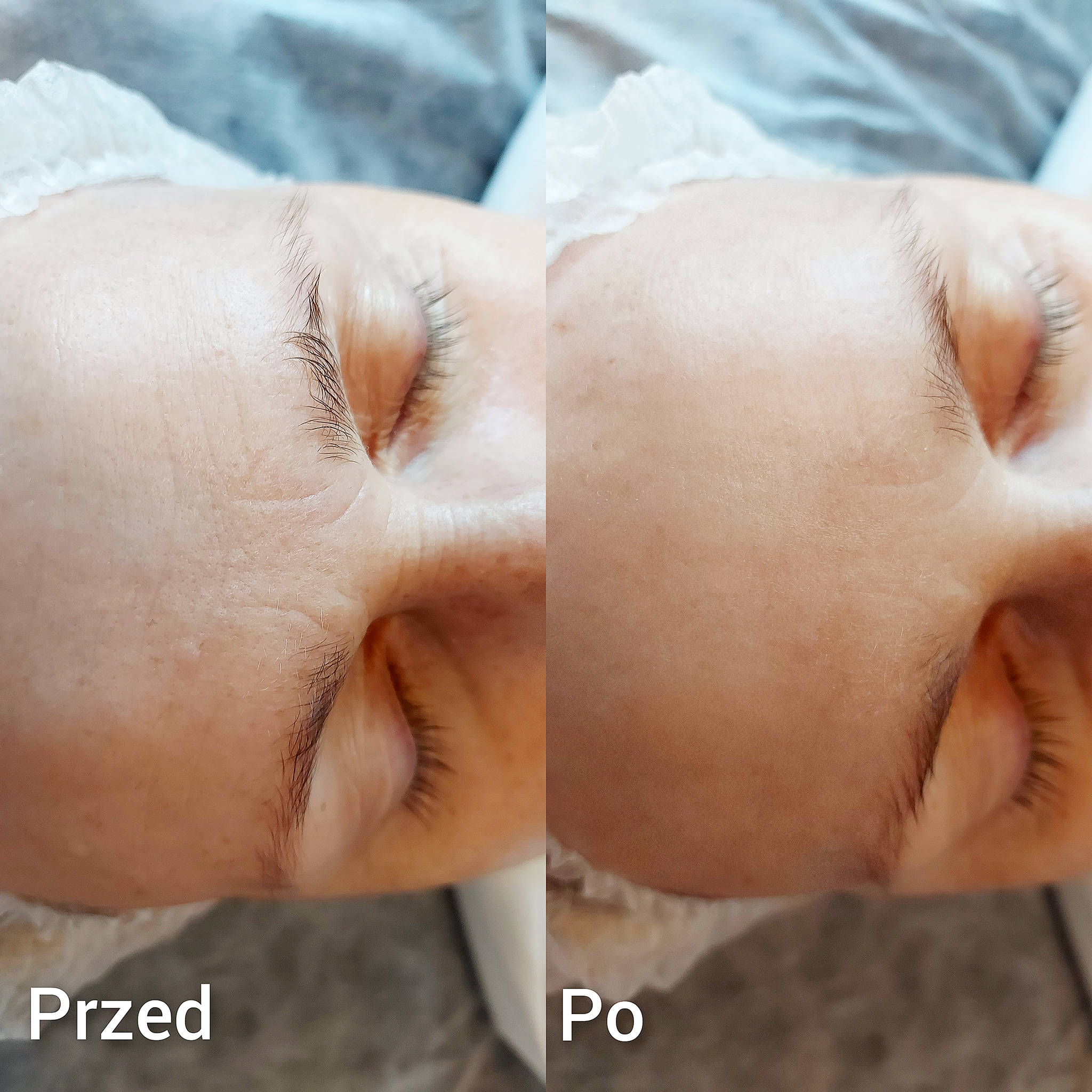 Fale Radiowe Opinie 3