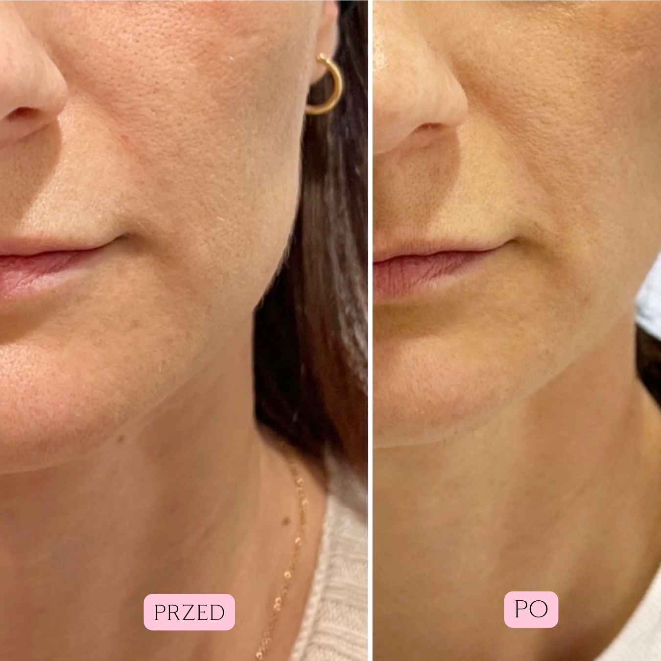 Fale Radiowe Opinie 6