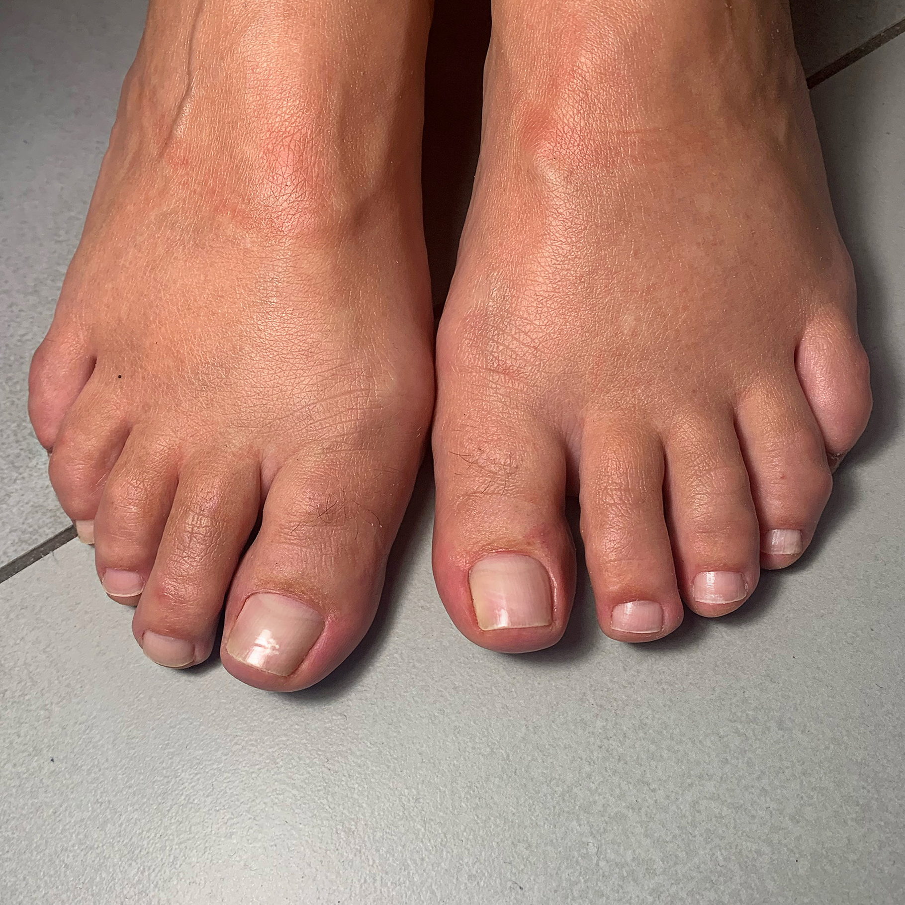 Pedicure Japoński Efekty 1