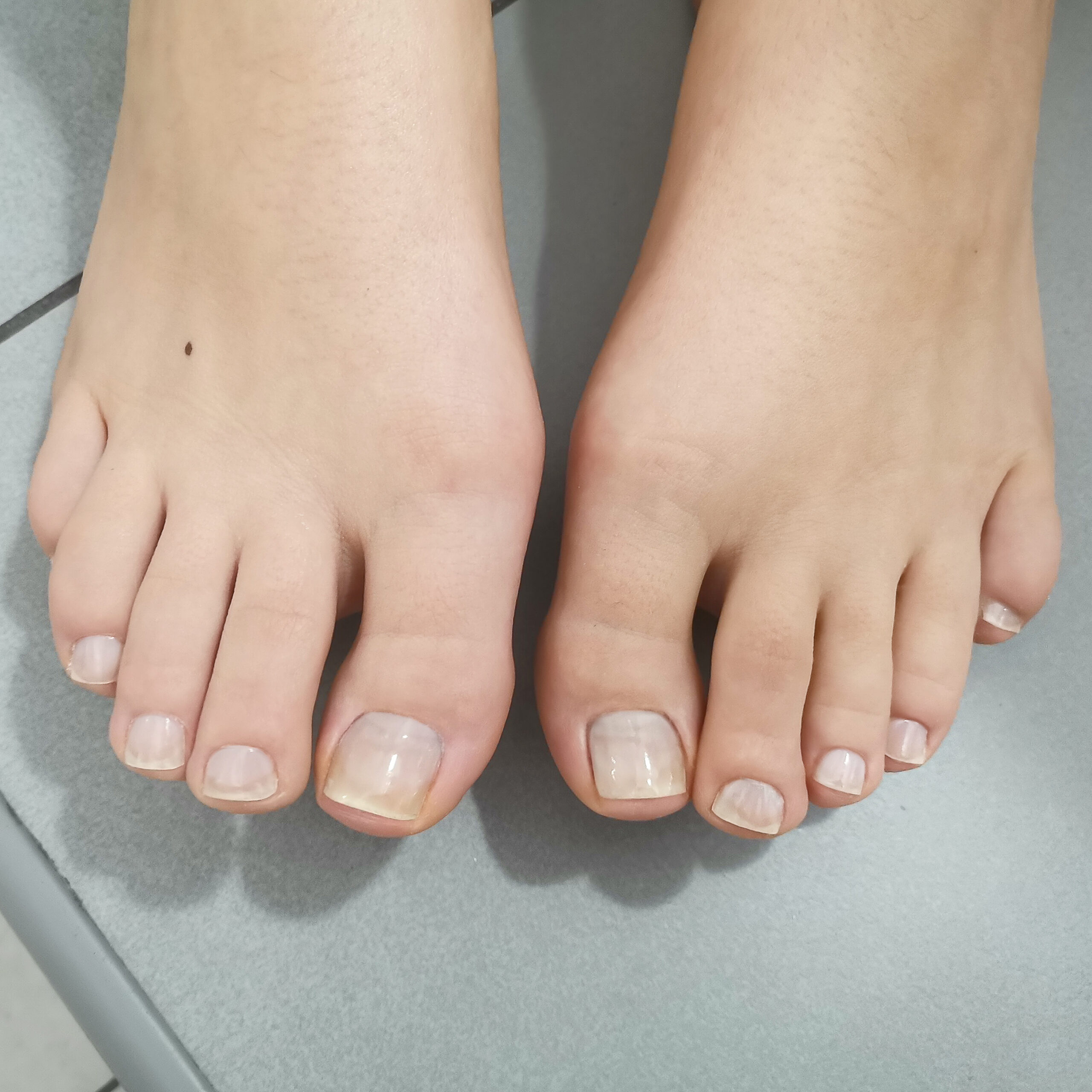 Pedicure Japoński Efekty 3