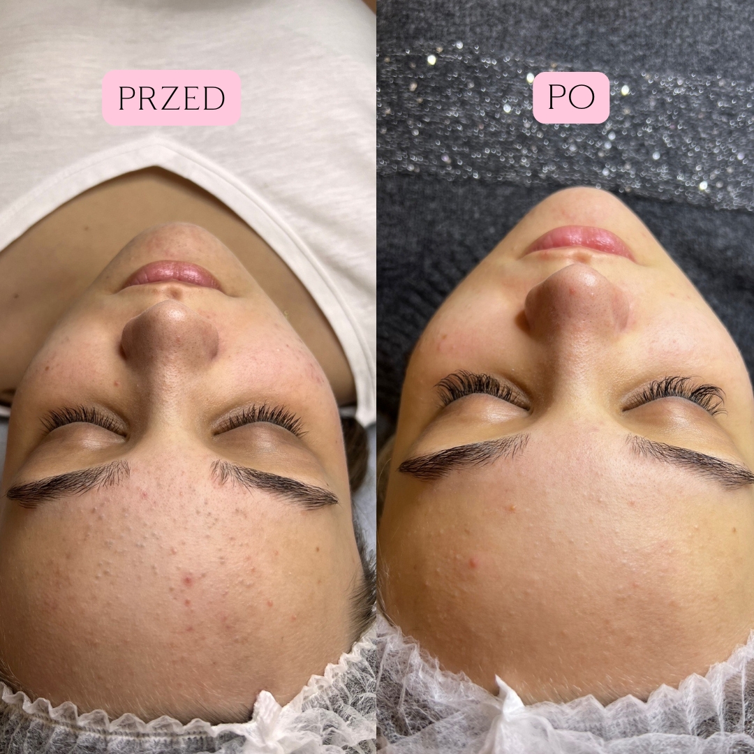 Sebo Purity Efekty 2