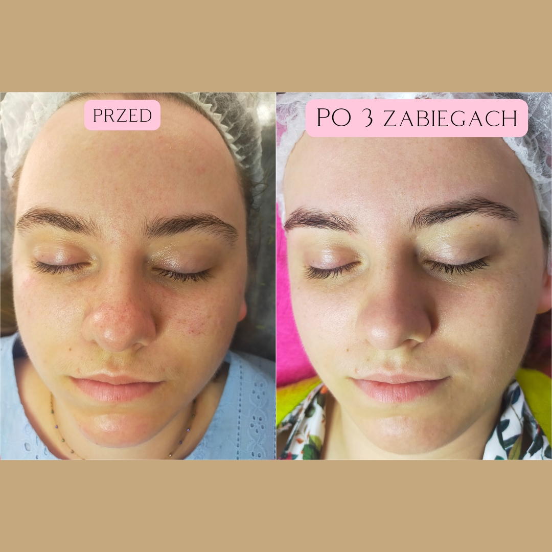 Sebo Purity Efekty 3