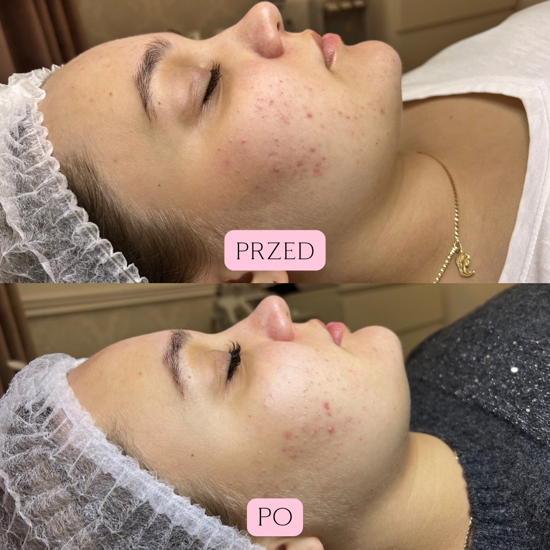 Sebo Purity Efekty 4