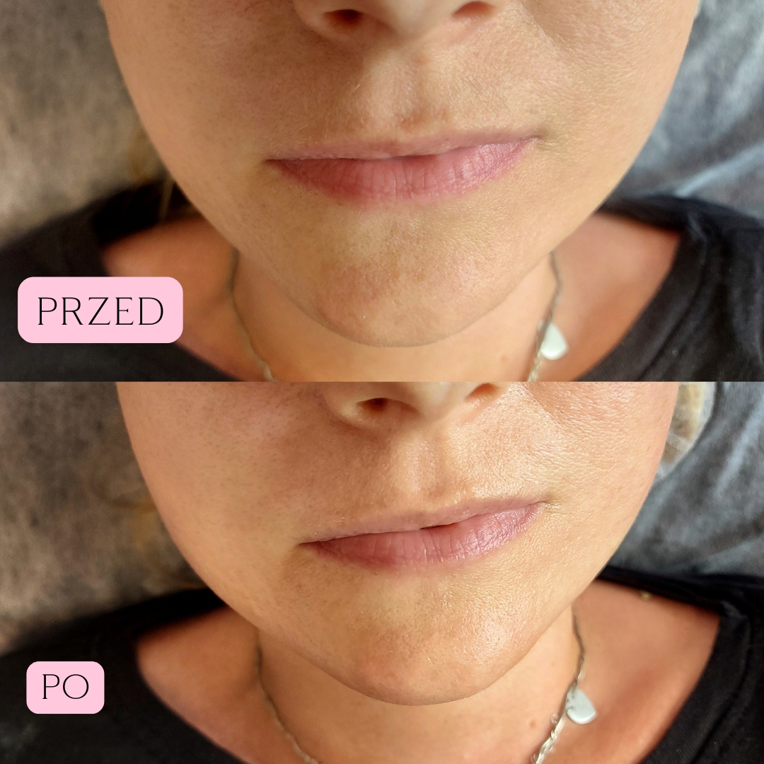 Sebo Purity Efekty 6