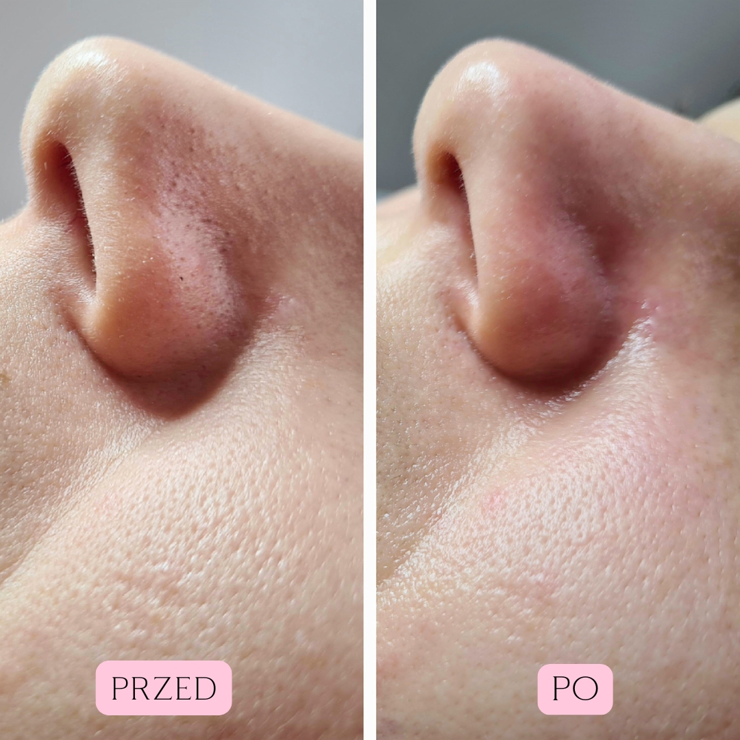 Sebo Purity Efekty 9