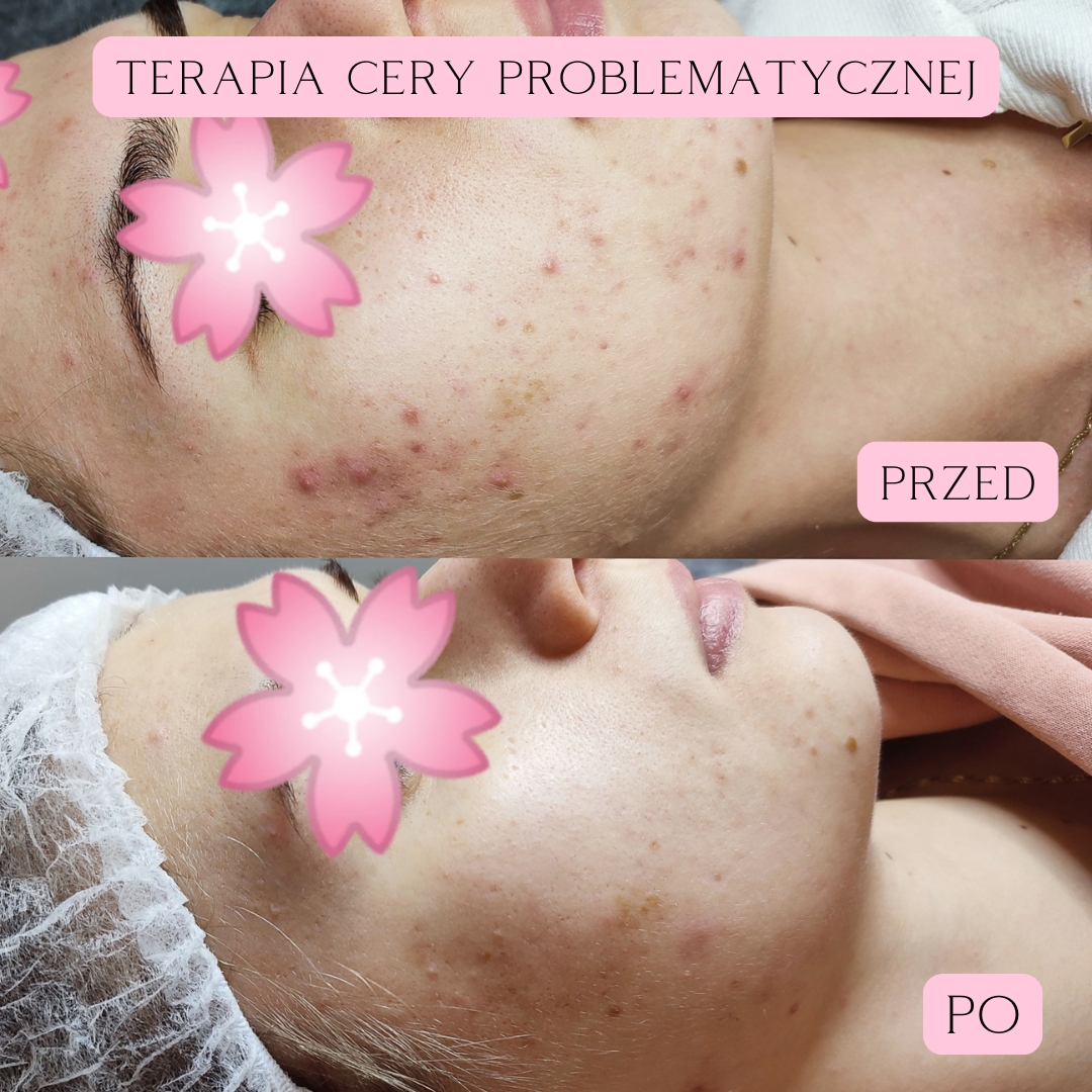 terapia nanili 03-2025 1