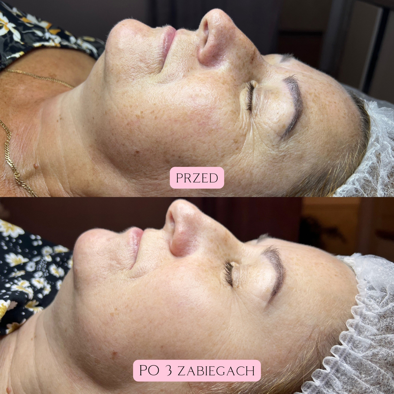 Zdjęcia na stronę - 5