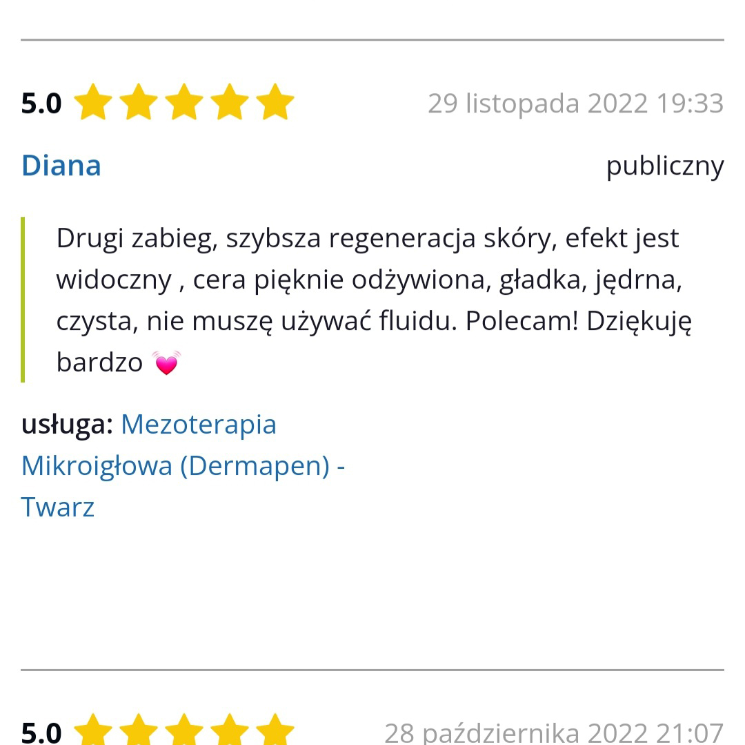 Mezoterapia Mikroigłowa Opinie 4