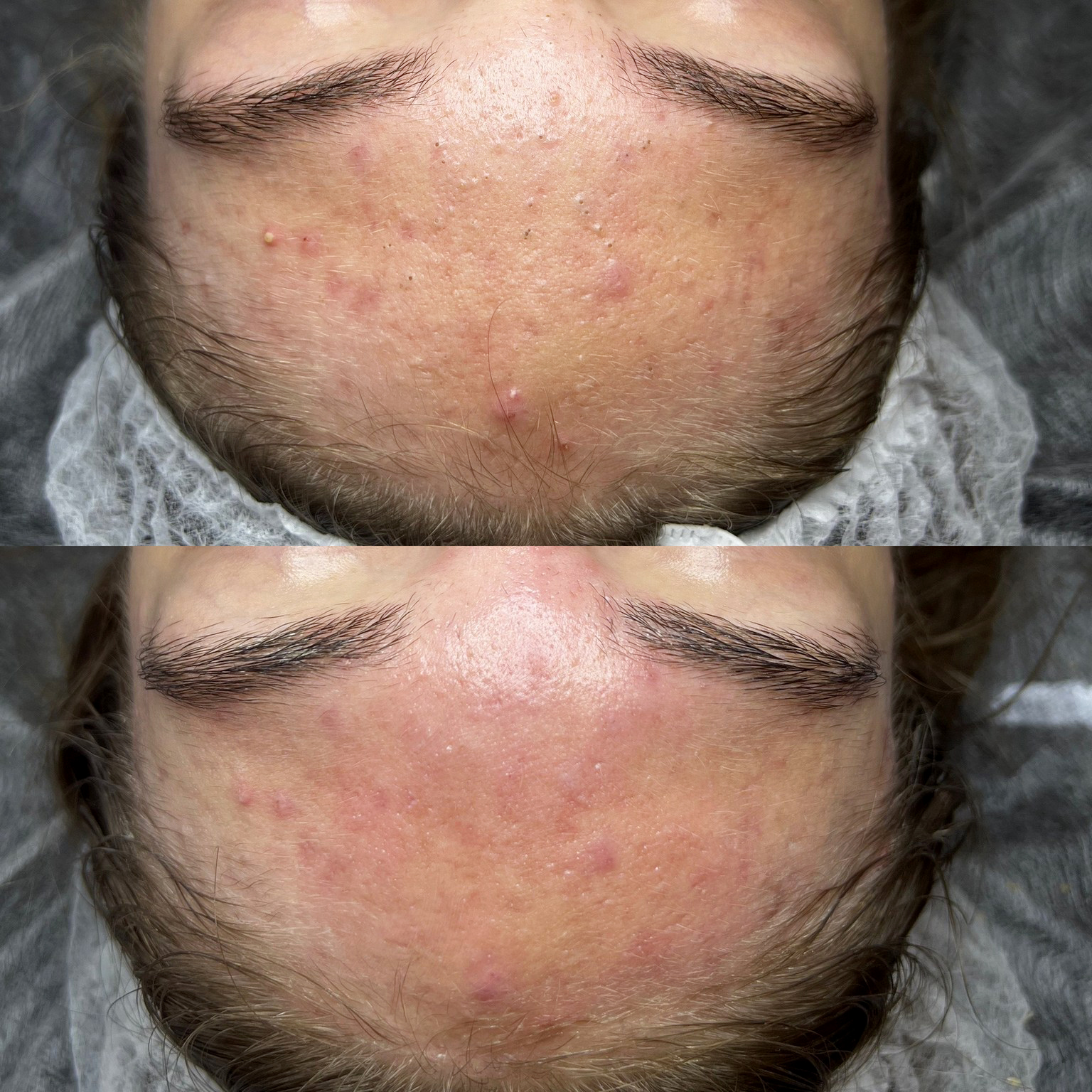 Strefa Mężczyzn Efekty 5