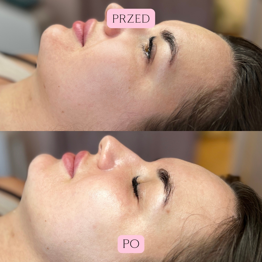 Summer Glow Efekty 1