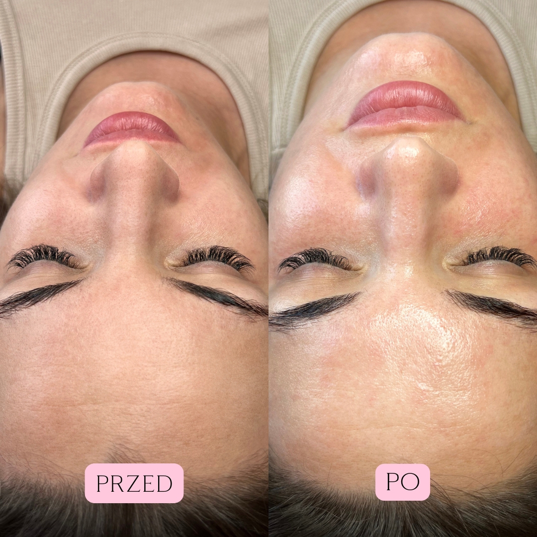 Summer Glow Efekty 2