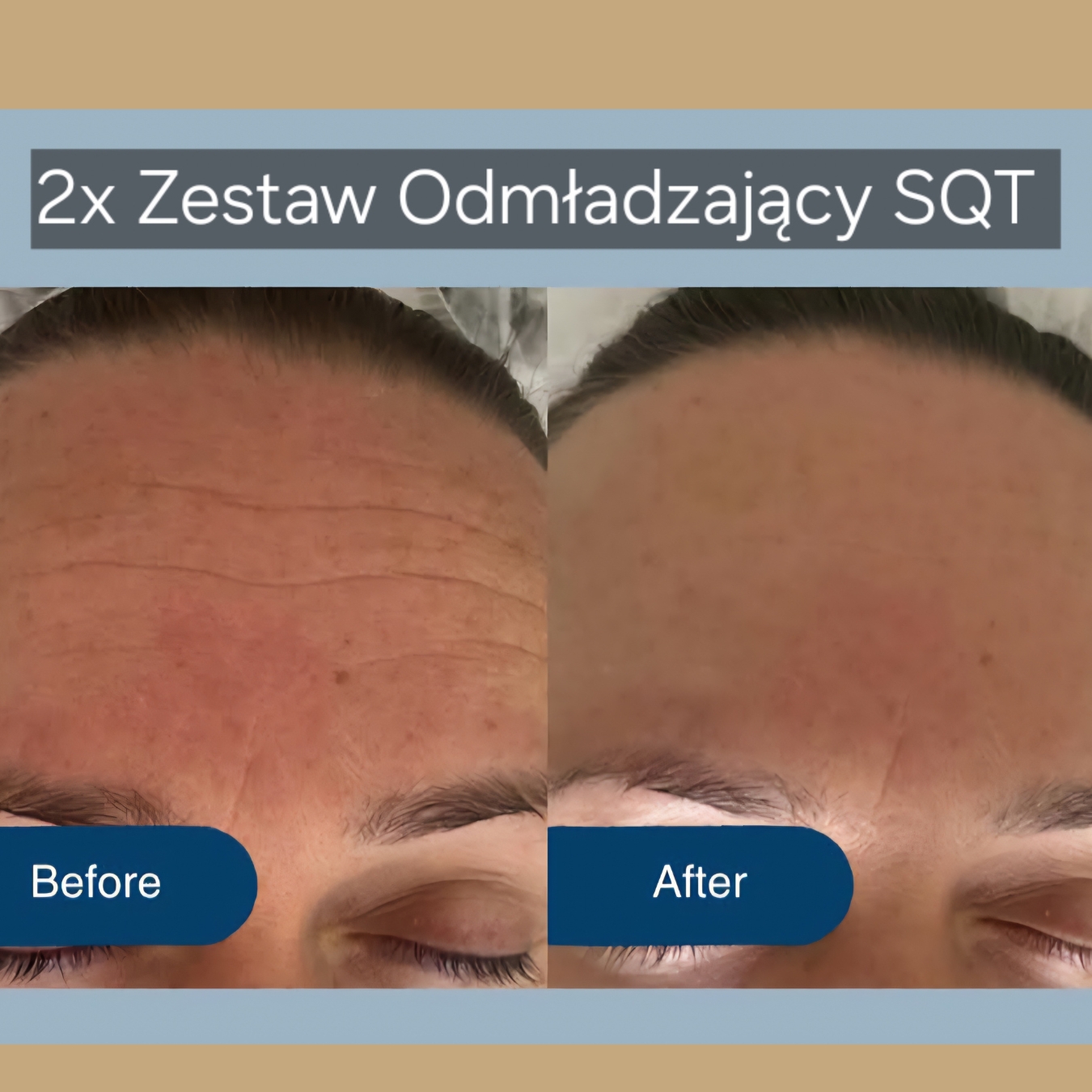 SQT Odmładzający 5