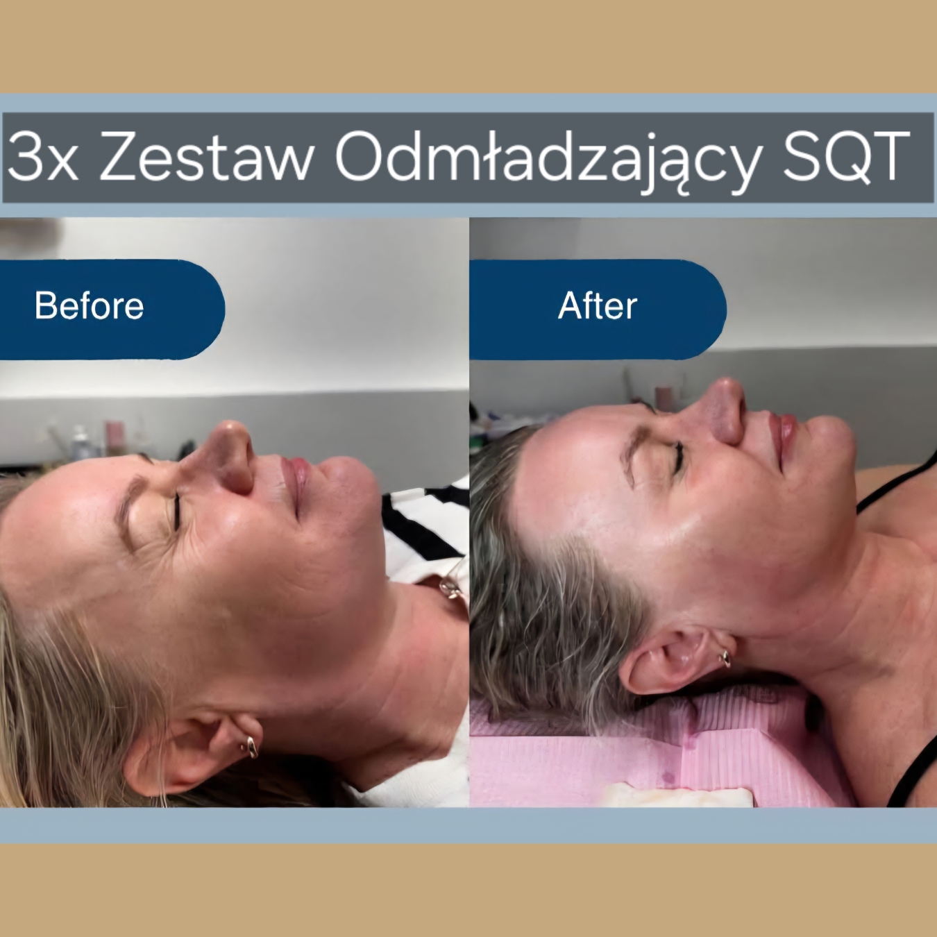 SQT Odmładzający 6
